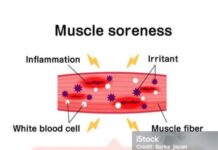 근육통, 왜 생기고 어떻게 풀어야 할까?
