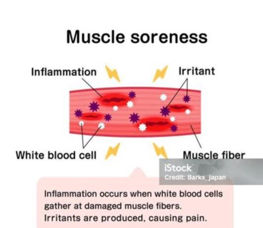 근육통, 왜 생기고 어떻게 풀어야 할까?
